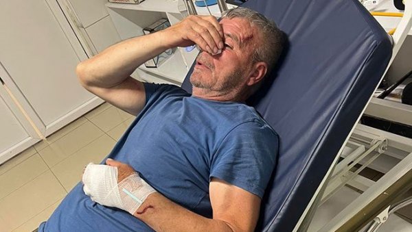 ПРЕТУЧЕН СРБИН ИЗ КОСОВСКОГ ПОМОРАВЉА ДОК ЈЕ ПОКУШАО ДА ЗАШТИТИ СИНА: Претрпео бруталан напад од стране локалног Албанца